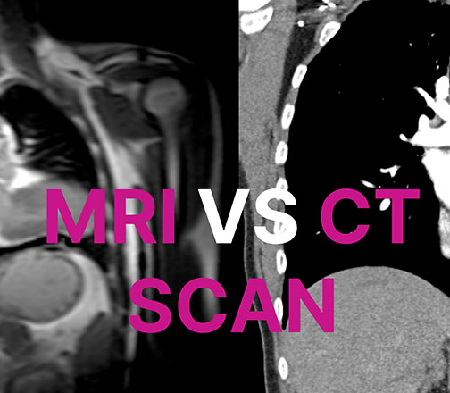 Battle of the Scanners: MRI vs. CT